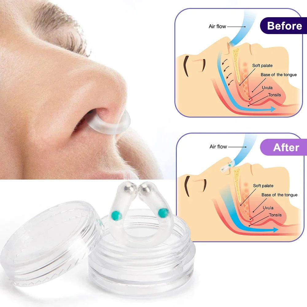 Anti Snoring Device Nose Clips Nasal Breathing Dilators Explosion Bead Snore Stopper Increase Sports Air Intake Improve Sleeping