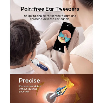Wax Removal Tool Camera, Ear Cleaner with Flexible Wireless Ear Camera Otoscope, Painless Visual Ear Pi