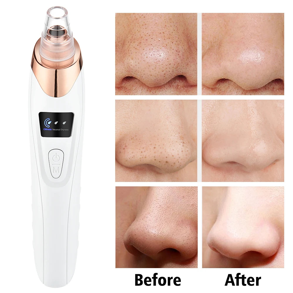 Electric Blackhead Remover Device Acne Pimple Black Heads Cleaner Machine Exfoliator Suction Facial Cleaning Pore Skin Care Tool
