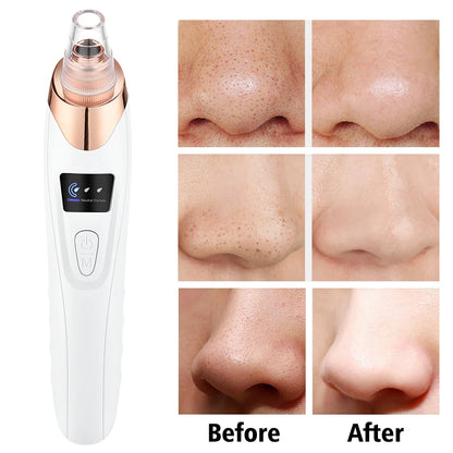 Electric Blackhead Remover Device Acne Pimple Black Heads Cleaner Machine Exfoliator Suction Facial Cleaning Pore Skin Care Tool