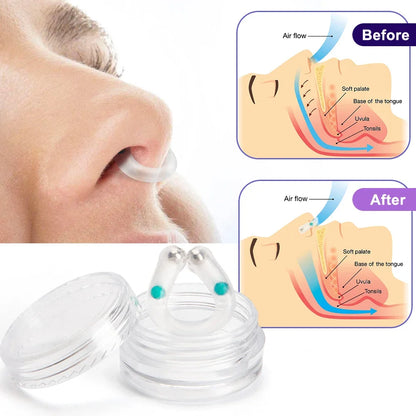Anti Snoring Device Nose Clips Nasal Breathing Dilators Explosion Bead Snore Stopper Increase Sports Air Intake Improve Sleeping