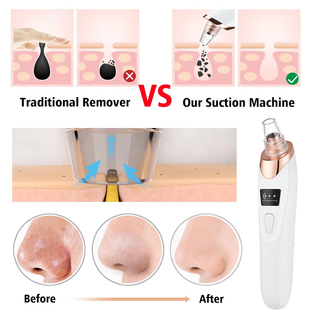 Electric Blackhead Remover Device Acne Pimple Black Heads Cleaner Machine Exfoliator Suction Facial Cleaning Pore Skin Care Tool